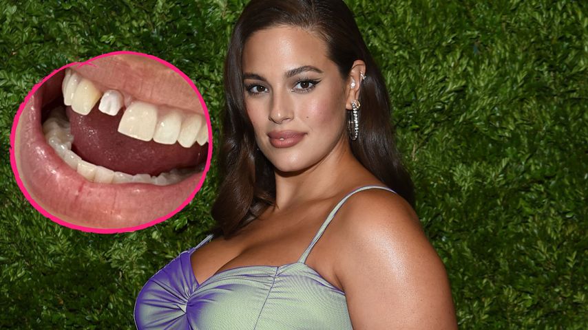 Hochschwangerer Ashley Graham wird Veneer rausgeschlagen!