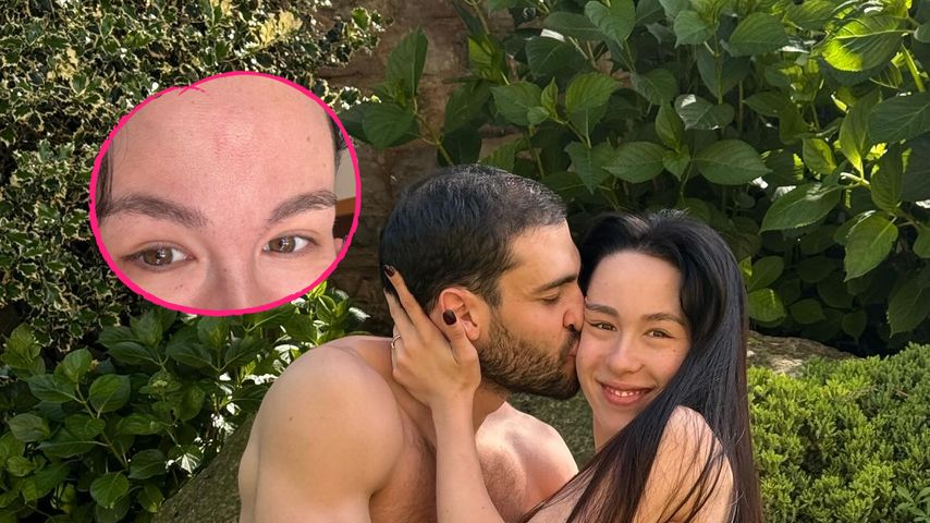 Aurora Ramazzotti kassiert 30 Mückenstiche für ein Foto!