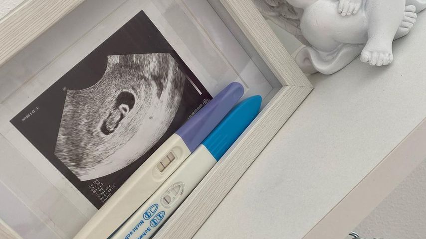 Baby-Ultraschallbild und Schwangerschaftstests von Saskia Atzerodt