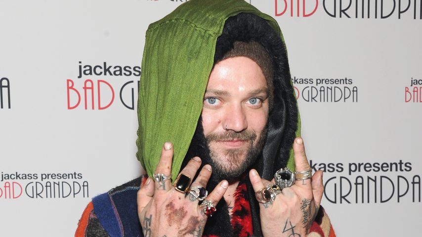 Bam Margera: Jackass-Star im Krankenhaus