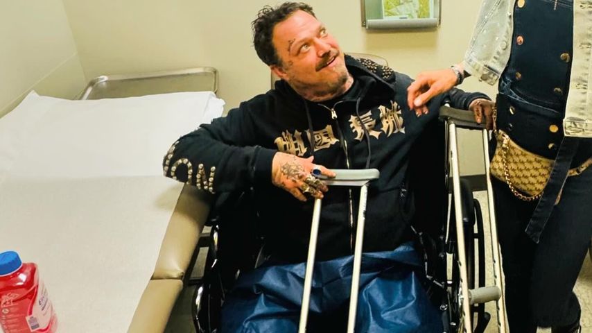 Bam Margera nach seiner Skate-Verletzung im März 2024
