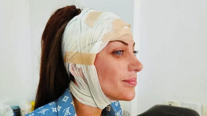 Barbara Jankavski machte eine Vielzahl von Schönheitsoperationen