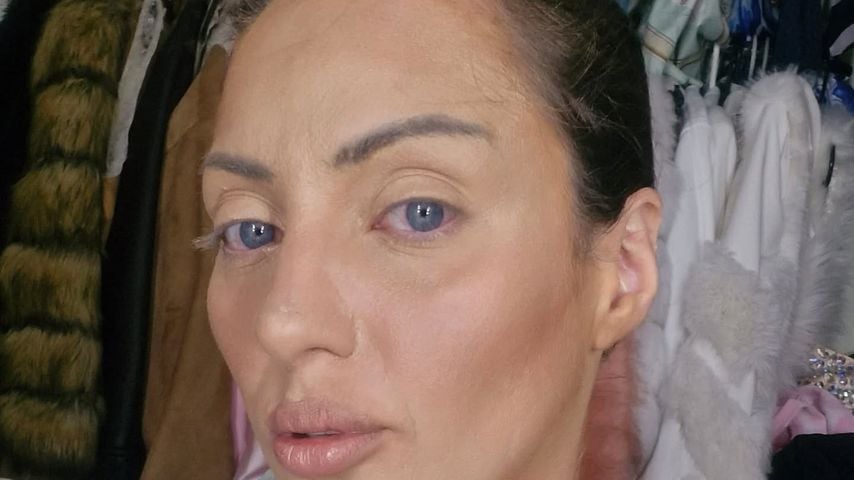 Die "Human Barbie" gab Einblicke in ihre Schönheitsoperationen