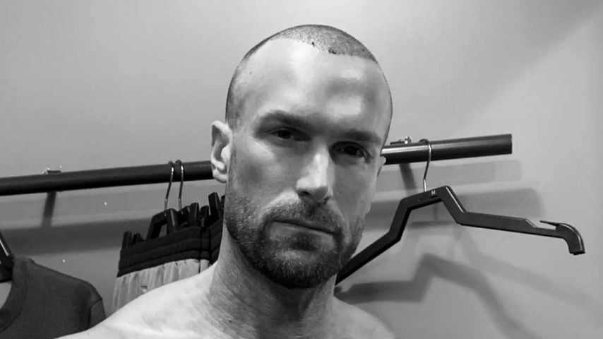 Ciao, lichte Stellen: Yotta lässt Haare transplantieren!