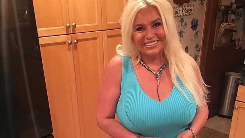 Beth Chapman