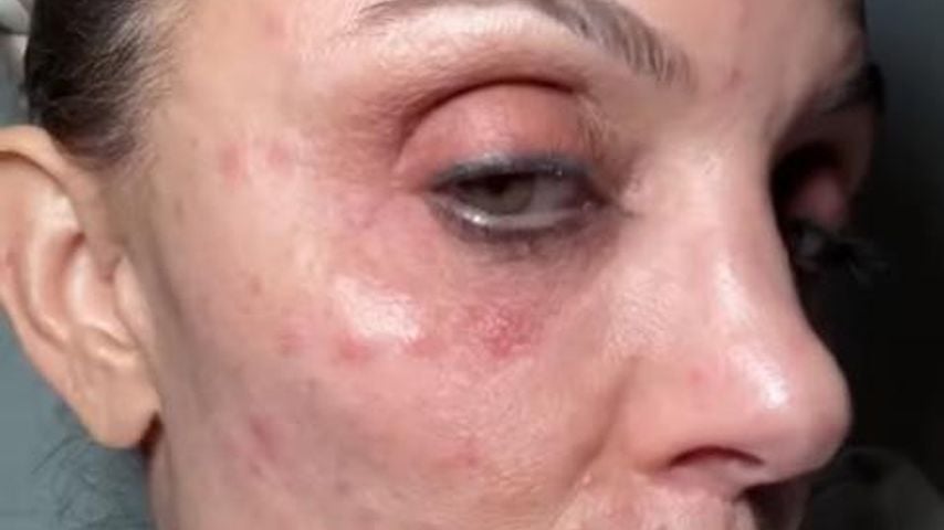 Bethenny Frankel, Januar 2026