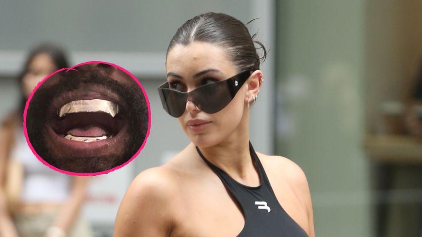 Bianca Censori nutzt Kanyes Titanzähne als Hintergrundbild!