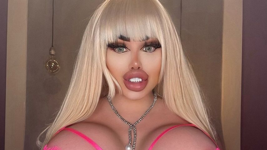 Lebensgefährliche Po-OP: Bibi Bugatti will reale Barbie sein