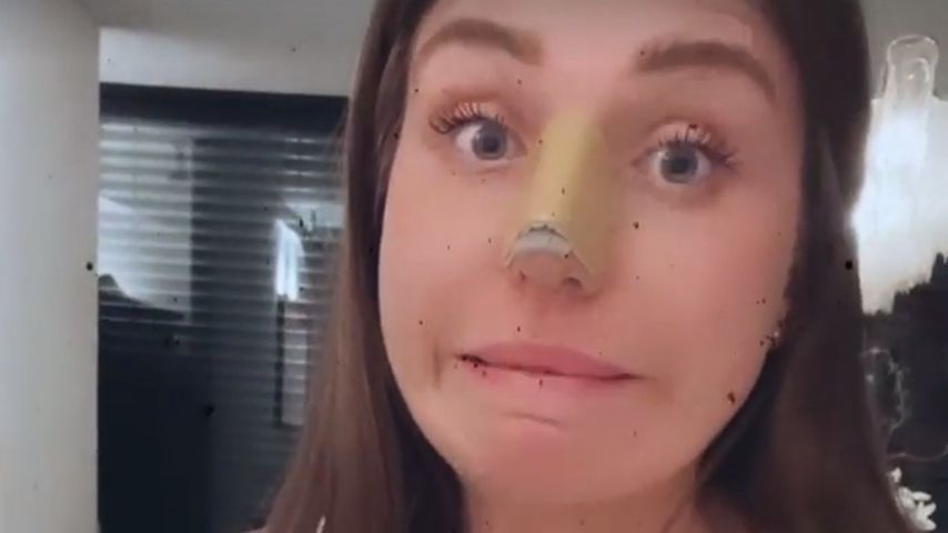 Bibi Claßen rund eine Woche nach ihren Beauty-Operationen