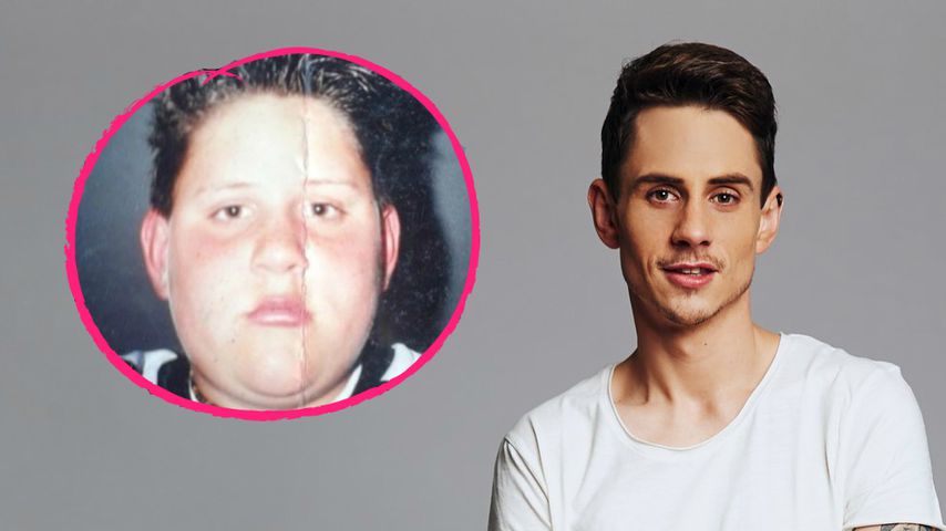 "Big Brother"-Pat wurde als Teenager für Aussehen gemobbt