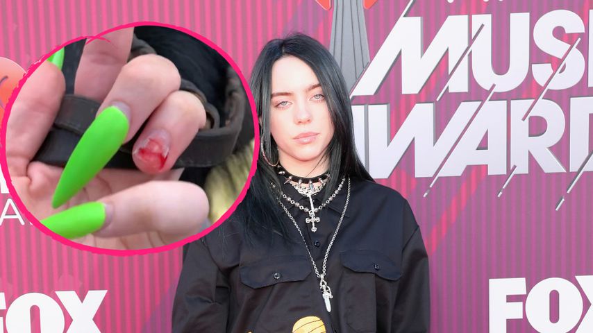 Alles blutig: Billie Eilish reißt sich künstlichen Nagel ab