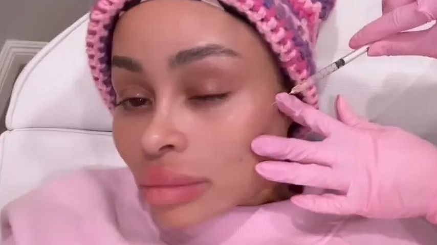 Zurück zur Natürlichkeit: Blac Chyna lässt Filler entfernen!
