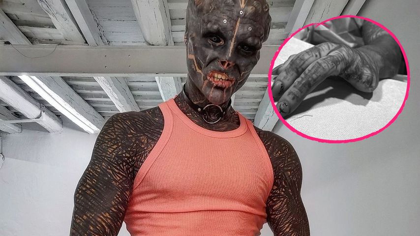 Zwei Finger amputiert! Franzose transformiert sich zum Alien