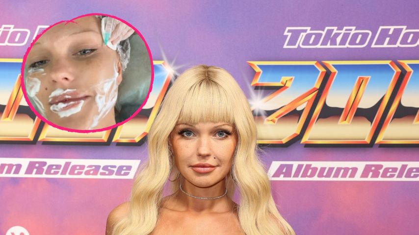 Fans feiern es: Bonnie Strange filmt sich beim Beauty-Doc