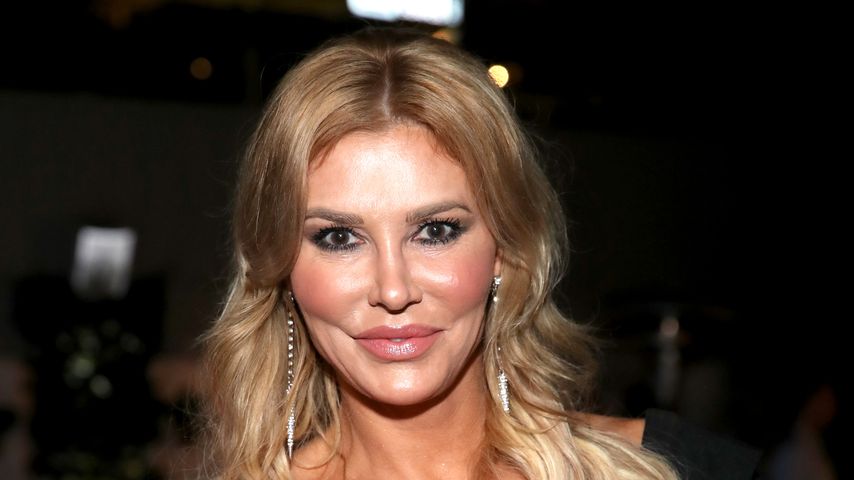 Brandi Glanville hat fünf Zähne durch Krankheit verloren