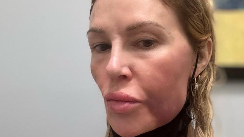 Online-Hass: Brandi Glanville kehrt aus Netz-Pause zurück