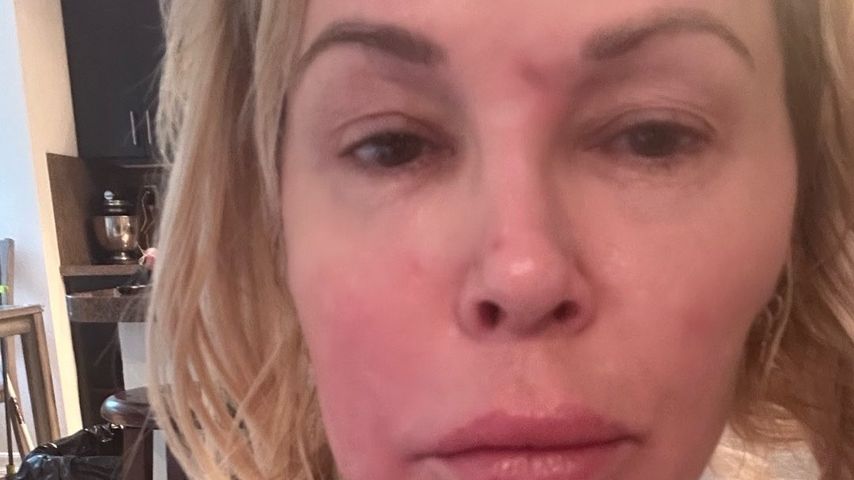 Brandi Glanville teilt ein besorgniserregendes Zittervideo