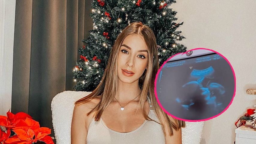 Intimer Einblick: Brenda Patea zeigt Ultraschall ihres Babys