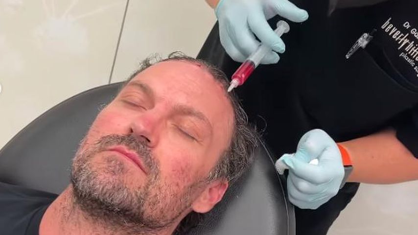 Brian Austin Green bei seiner Haarausfall-Behandlung