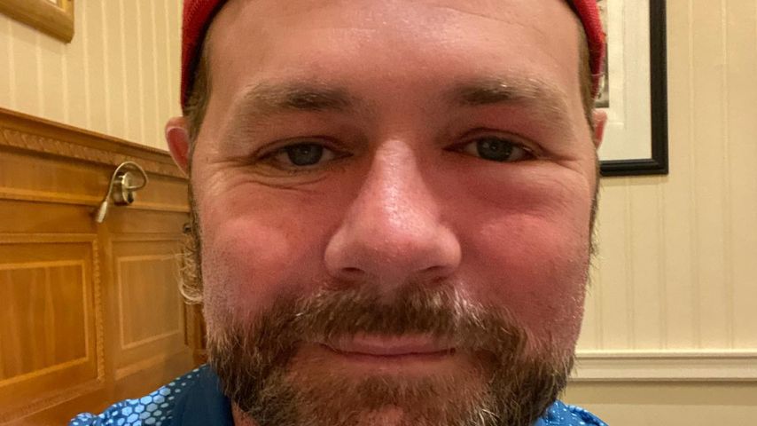 Brian McFadden nach seinem Bienenstich
