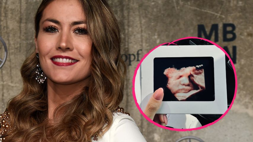 Schwangere Fiona Erdmann teilt süßes Baby-Ultraschallbild