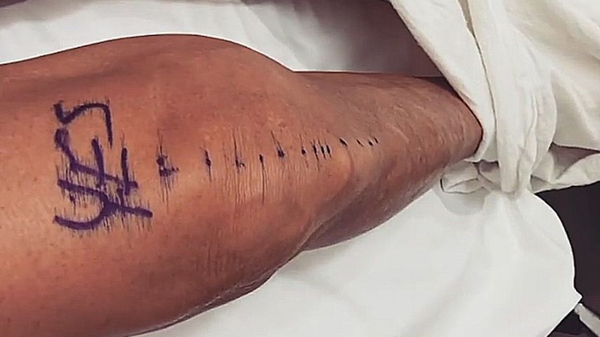 Caitlyn Jenners Knie vor der OP