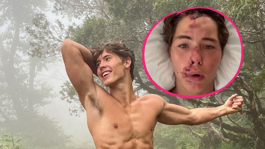 Erste Worte von TikToker Caleb Coffee nach Klippensturz!