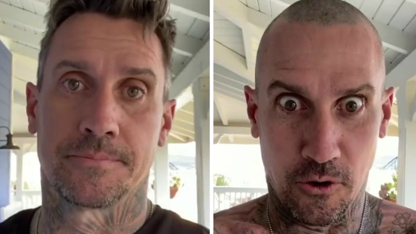 Carey Hart