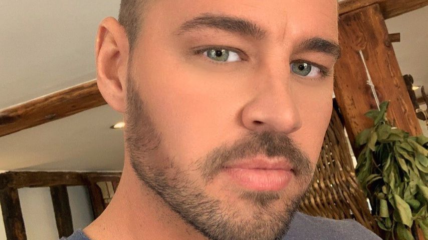 "Love Island"-Star Carl Woods