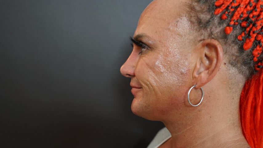Caroline Robens nach ihrer Beauty-Behandlung