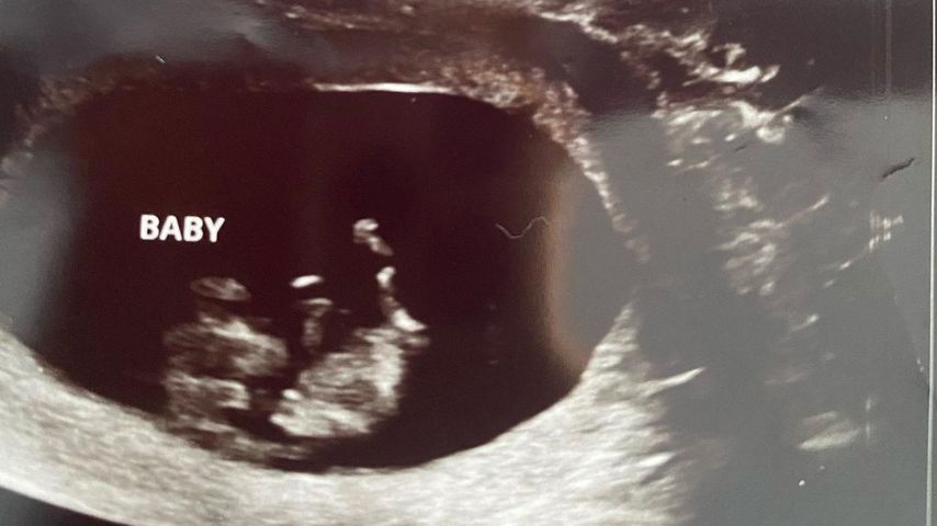 Catelynn Lowells Ultraschallbild, Februar 2021