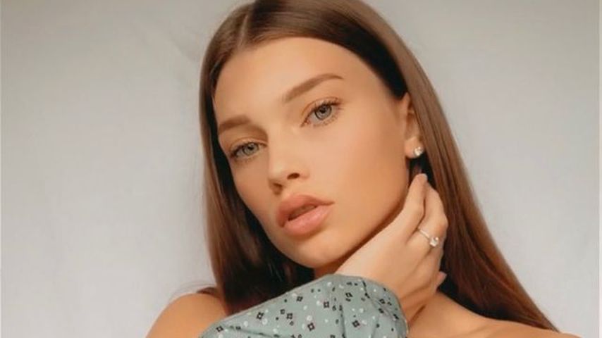 Wegen Krankheit: GNTM-Chanel wurde schon 32 Mal operiert!