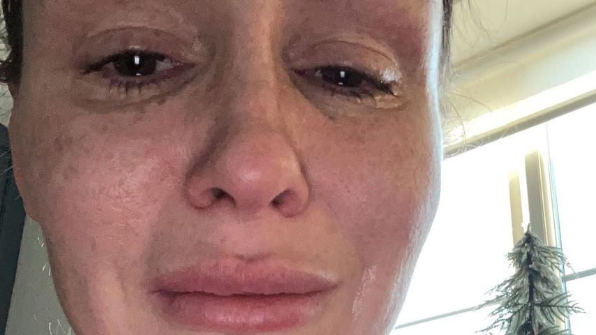 "Es geht mir nicht gut": Chanelle Hayes teilt traurige Fotos