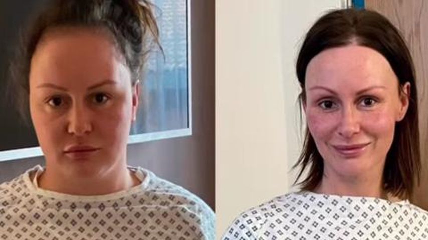 Chanelle Hayes' Verwandlung