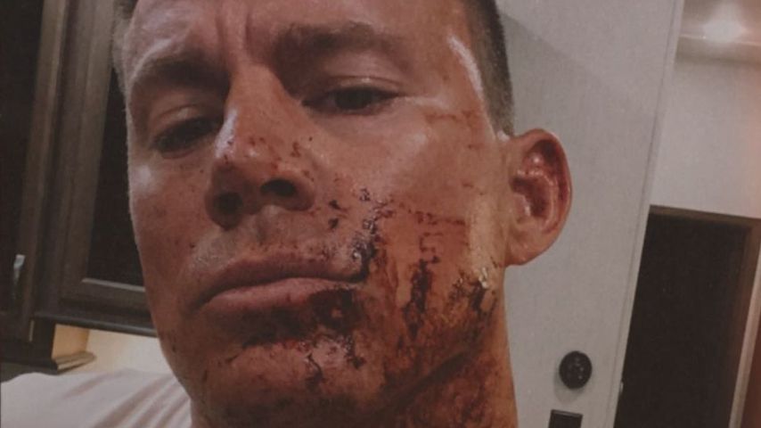 Blutverschmiert: Was ist hier mit Channing Tatum passiert?