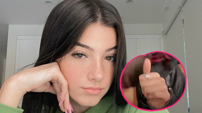 Trotz Split: TikTok-Charli trägt Chase' Freundschaftsring!