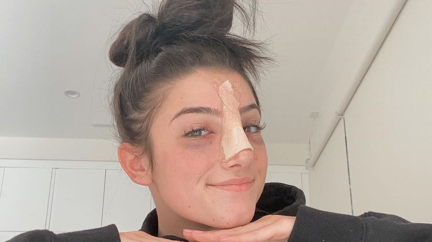 Beauty-Eingriff? TikTok-Star Charli D'Amelio hatte Nasen-OP