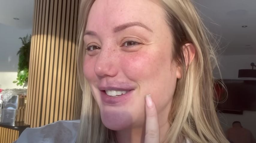 UK-Star Charlotte Crosby ließ sich ihre Lipfiller entfernen!