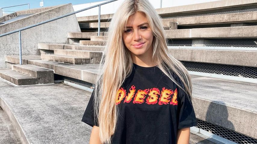"Fix und fertig": "Love Island"-Chiara erleidet Rollerunfall