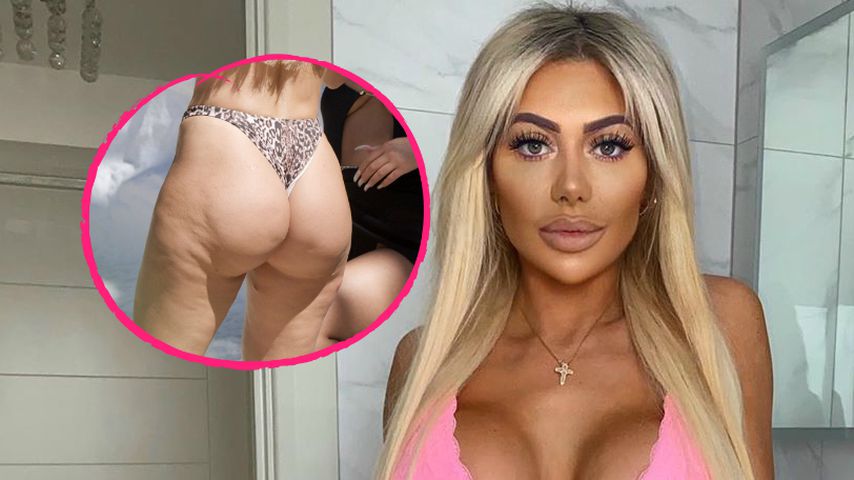 Üppig: Chloe Ferry zeigt das Ergebnis ihrer Po-Vergrößerung