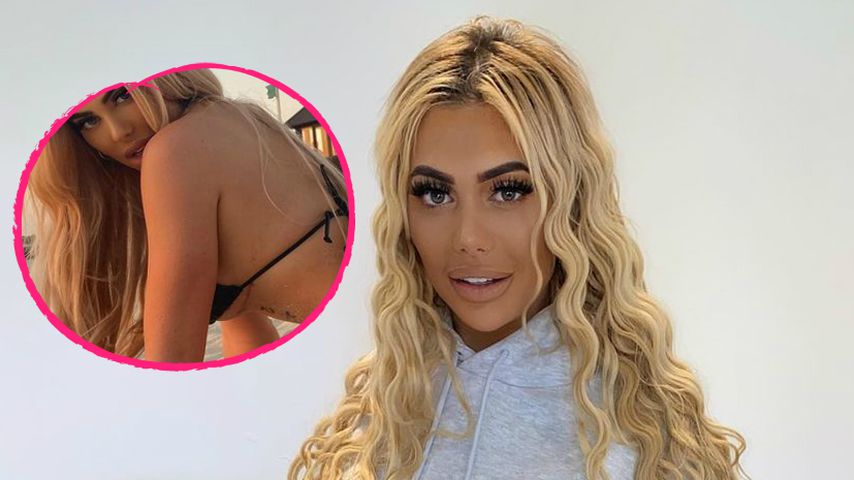 Aus Versehen? Hier sieht man Chloe Ferrys Brust-OP-Narben