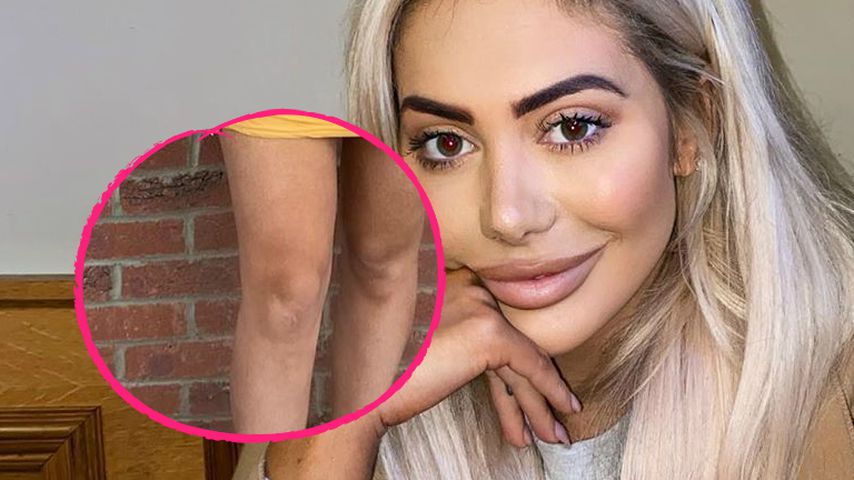 Chloe Ferry schummelt sich mit Photoshop schlankere Beine