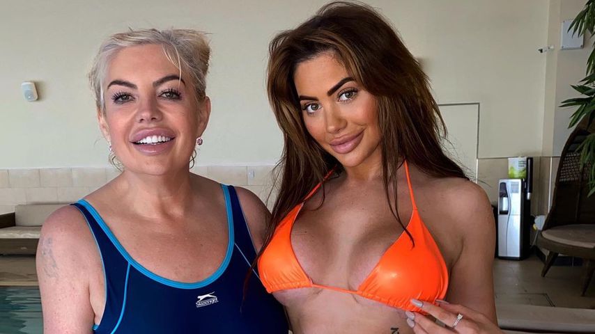 Dank Beauty-OPs? So ähnlich sieht Chloe Ferry ihrer Mutter