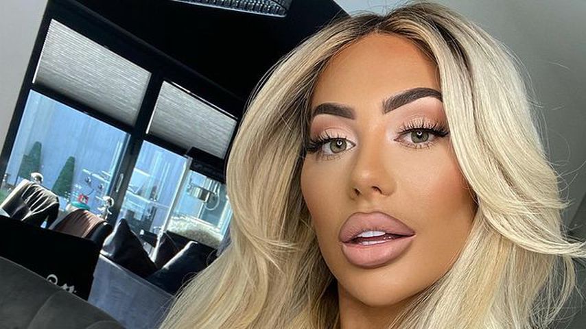 Chloe Ferry