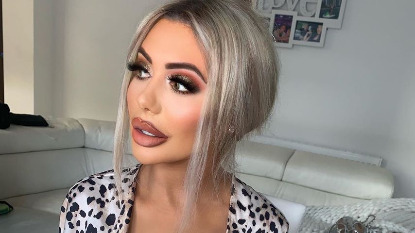 Nach Herzschmerz-Diät: Fans sorgen sich um Chloe Ferry