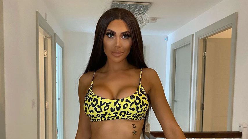 Kaum erkannt: Bräunungsfail von Chloe Ferry sorgt für Lacher