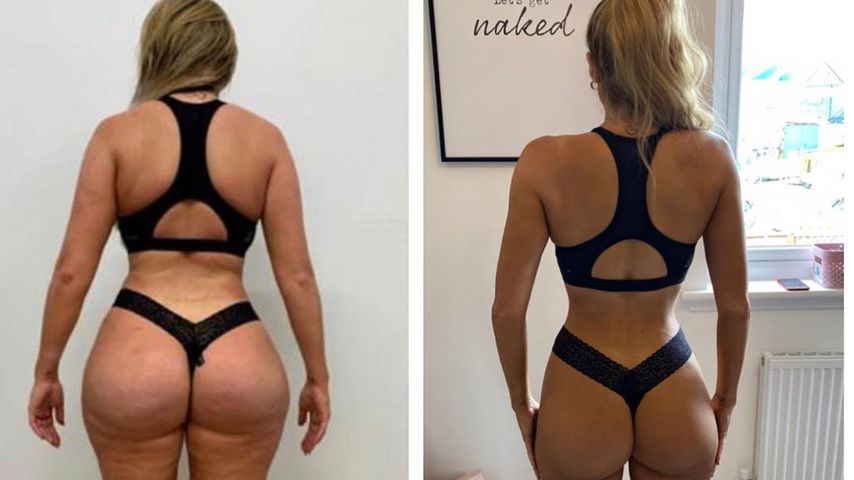 Chloe Ferrys Vorher-Nachher-Vergleich
