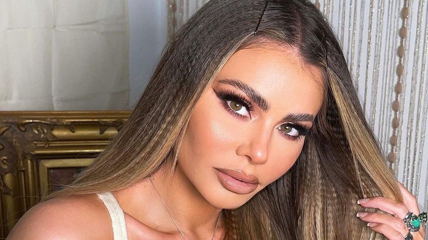 Bye bye, Filler! Chloe Sims macht Beauty-Eingriff rückgängig