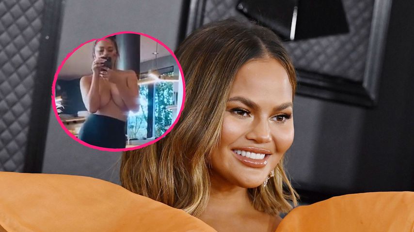 Nach Brust-OP: Model Chrissy Teigen zeigt sich oben ohne
