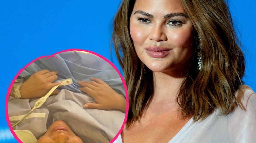 Chrissy Teigen teilt intimen Einblick in ihren Kaiserschnitt